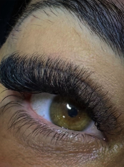 0 - À POSTAR - tratamento para melasma 1