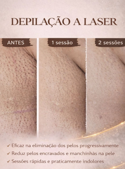 10 - Depilação a Laser na Virilha 1