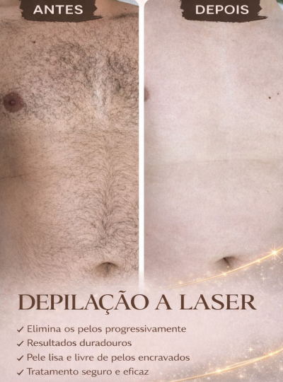 9.1 - Depilação a Laser Corpo Todo 1